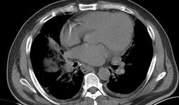 吃瓜爆料17c.ct,吃瓜爆料背后的真相与内幕
